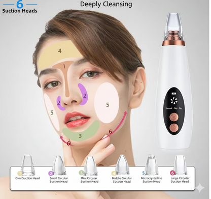 PERFLU Multi-function Blackhead Remover Tools | Electric Derma suction Machine