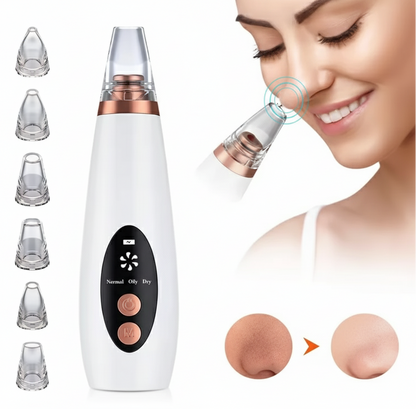 PERFLU Multi-function Blackhead Remover Tools | Electric Derma suction Machine