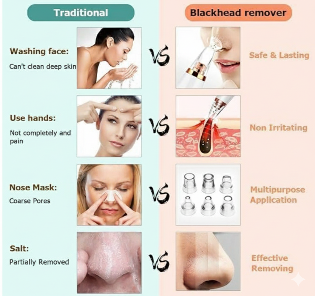 PERFLU Multi-function Blackhead Remover Tools | Electric Derma suction Machine